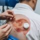 Pop that cyst videos